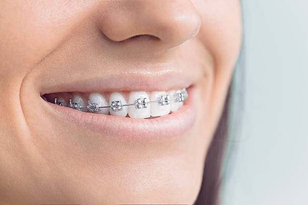 Best Veneers and Lumineers  in Harlingen, TX
